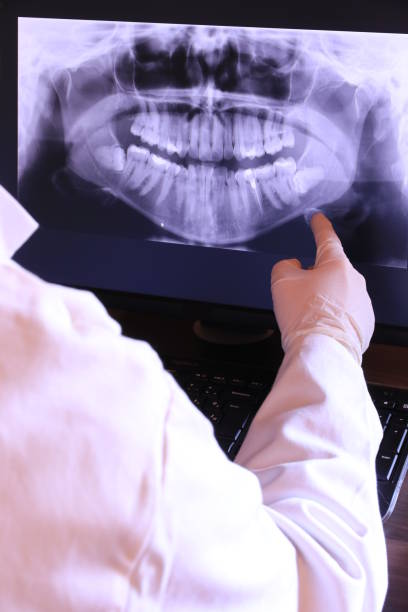 Best Dental Abscess Treatment in Monarch Mill, SC